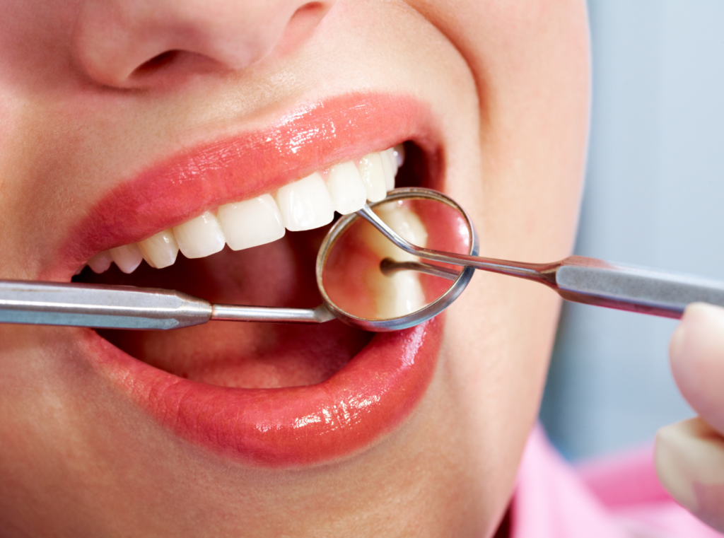 Close-up of a patient receiving a dental examination, with a focus on the patient's healthy teeth and the dental tools being used by the dentist. The image highlights the importance of regular check-ups in maintaining oral health.